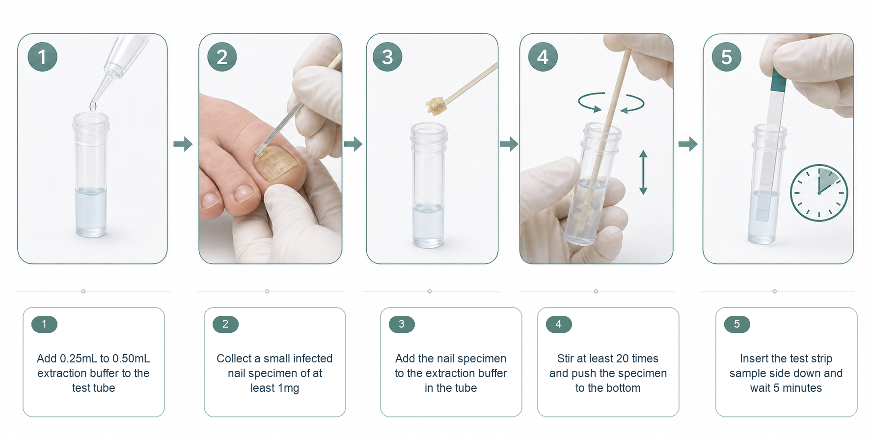 Fungal nail rapid test workflow diagram